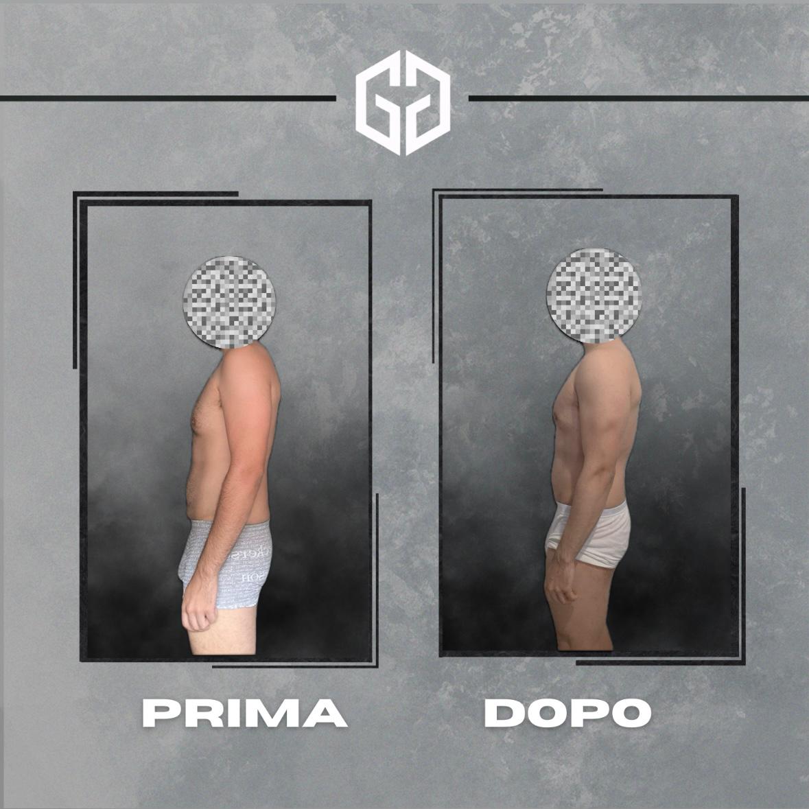 prima-dopo-3