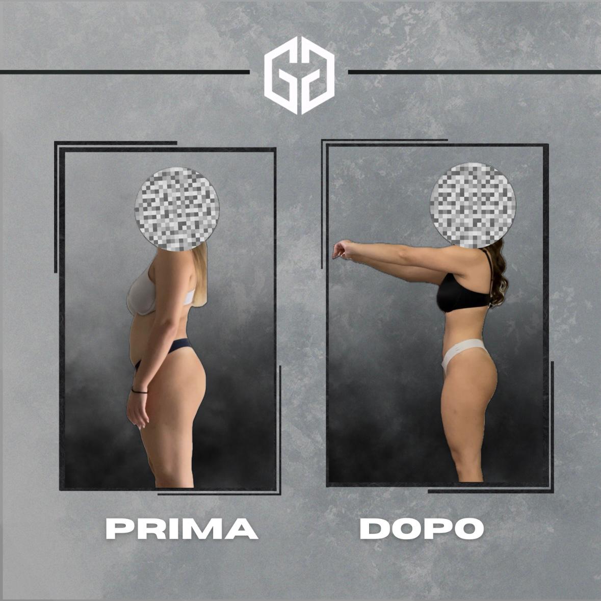 prima-dopo-6